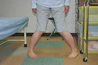 膝の施術