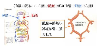 なぜリラックスした時に片頭痛になるの？