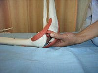 膝の施術
